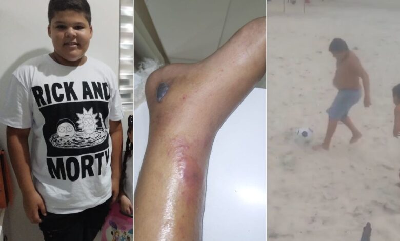 menino-de-12-anos-morre-apos-fraturar-tornozelo-no-futebol-e-familia-acusa-hospitais-de-negligencia:-‘dor-e-revolta’